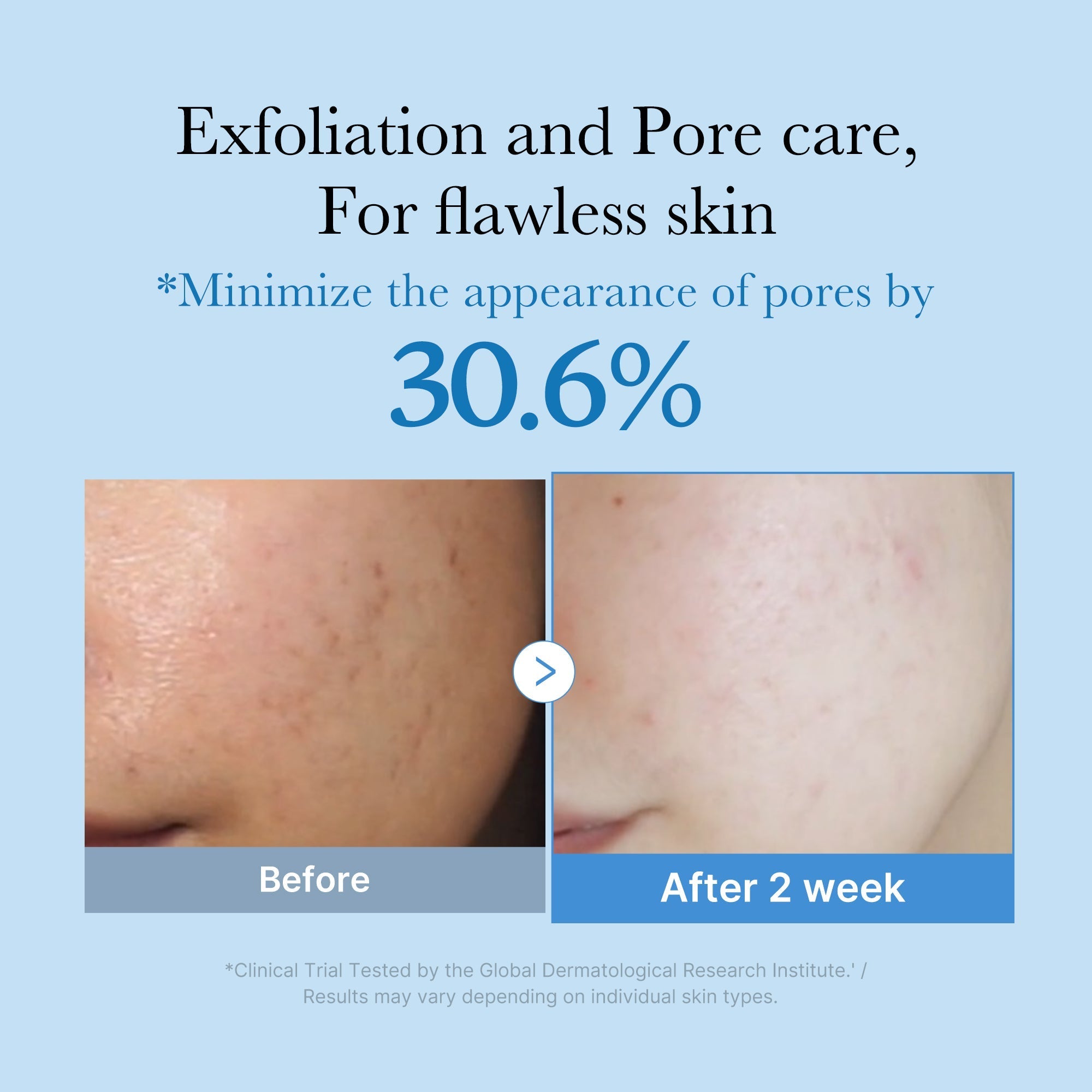 Zero Pore Toner - Hydration Made Easy