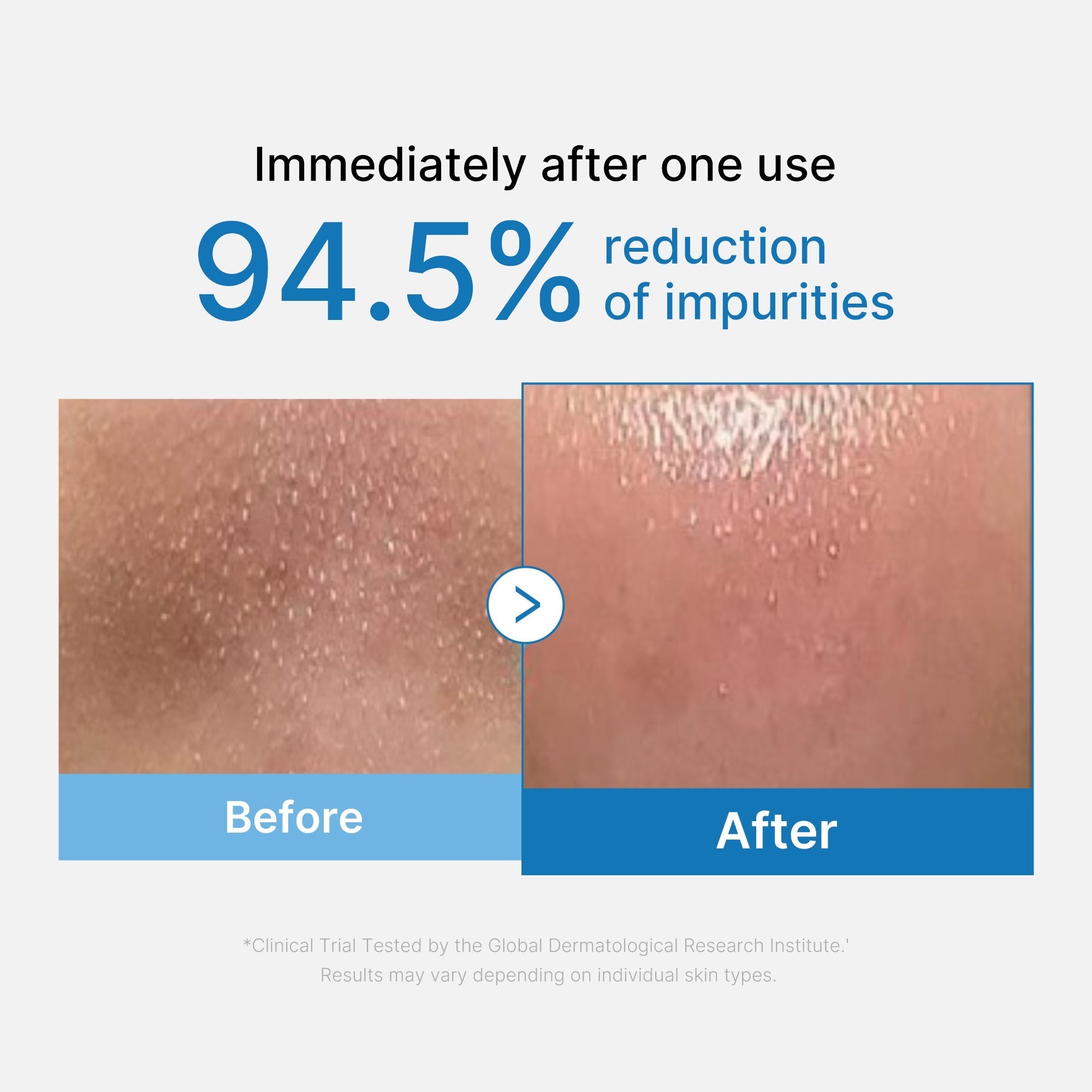 Zero Pore Blackhead Deep Cleansing Oil - Hydration Favorites
