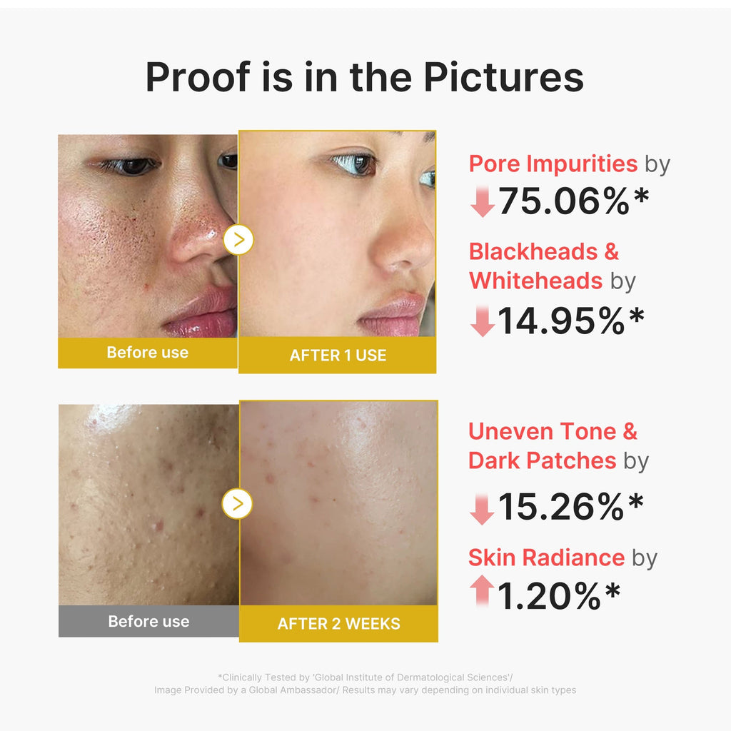 Kojic Acid Turmeric Peel Shot - Glow Routine Essential