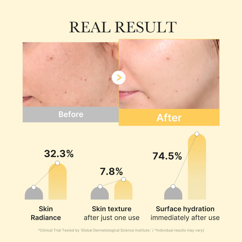 Kojic Acid Turmeric Gold Jelly Gel Mask - Beauty Routine Ready