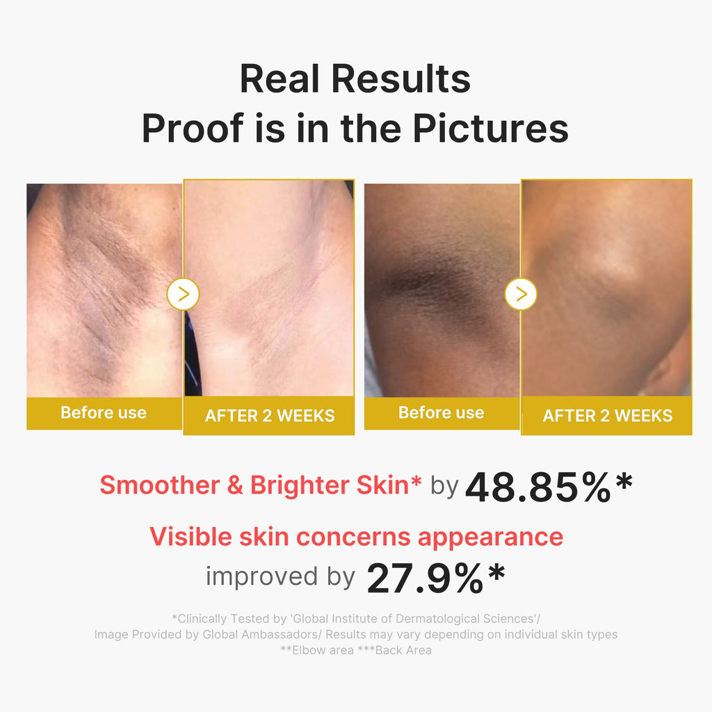 Kojic Acid Turmeric Body Peel Shot - Daily Beauty Care