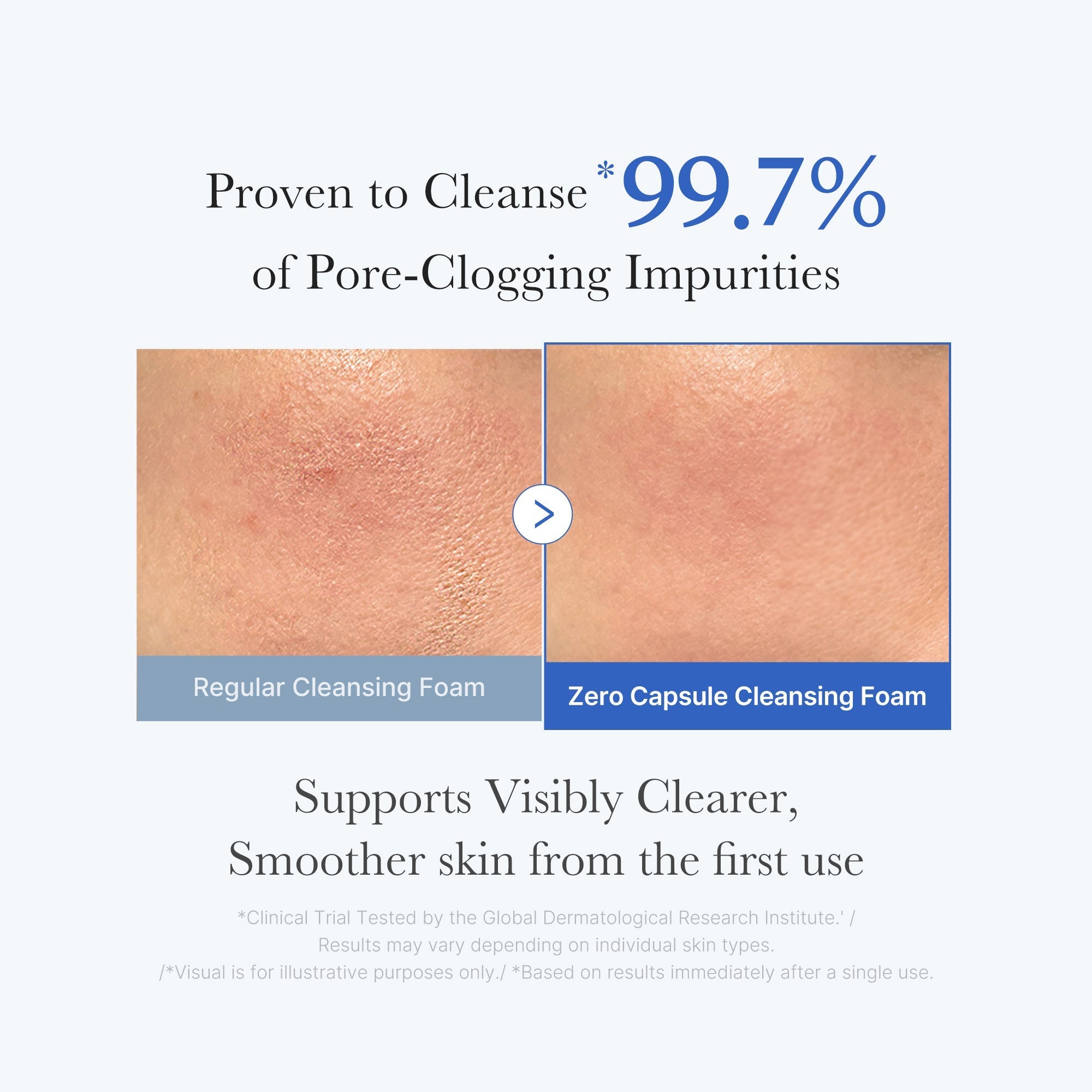 Zero Pore Capsule Cleansing Foam - Simple Beauty Care