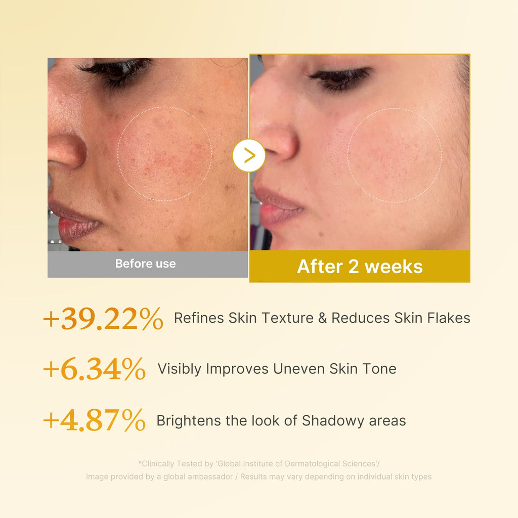 Kojic Acid Turmeric Toner - Glow On the Go
