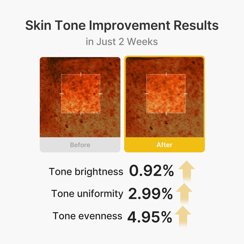 Kojic Acid Turmeric Vita Capsule Cream - Hydration Favorites