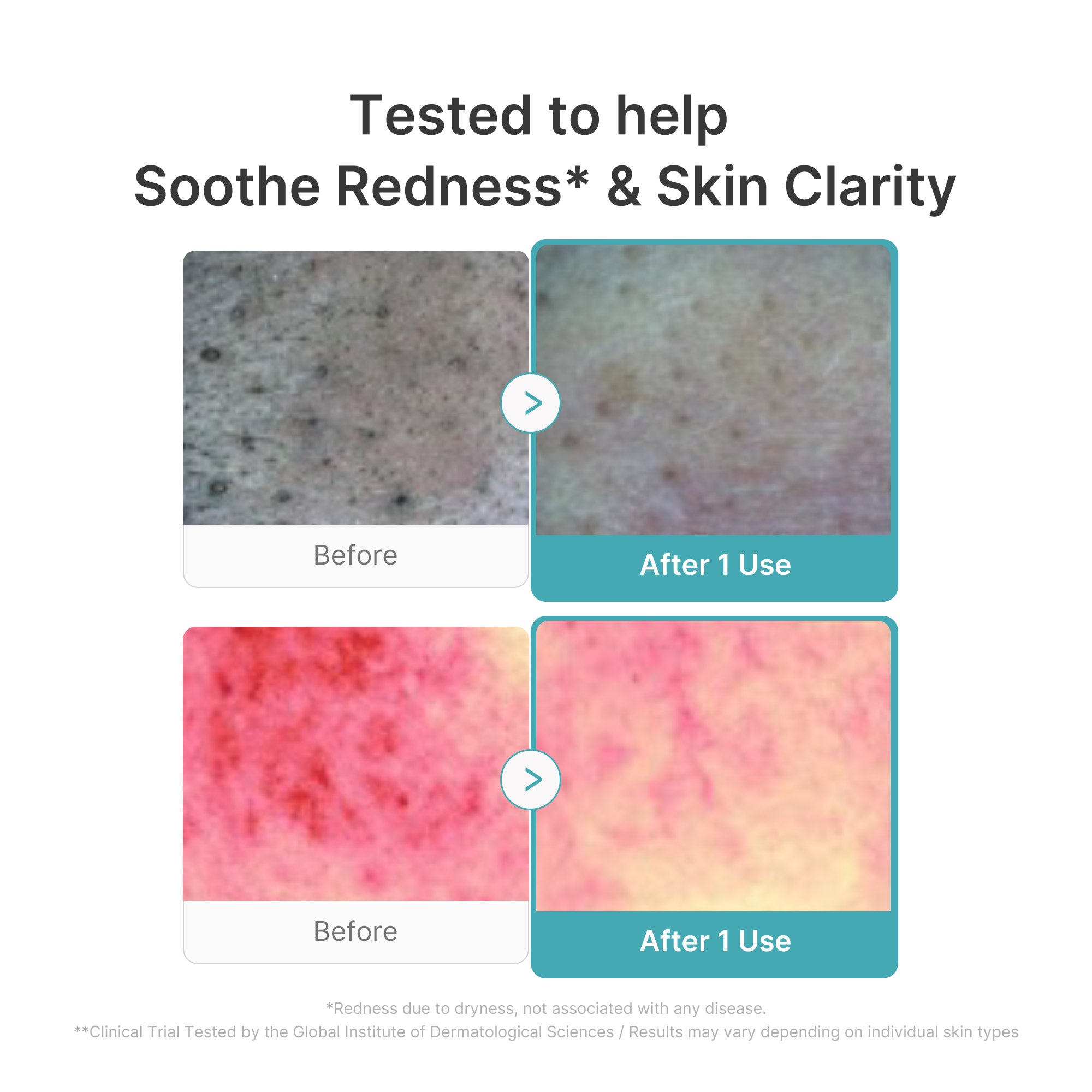Azelaic Acid Capsule Foam Cleanser - Your Glow Care
