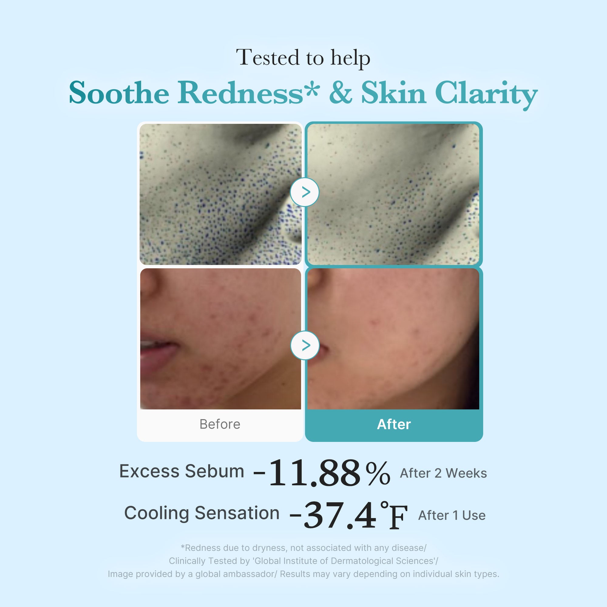 Azelaic Acid Niacinamide Clarifying Toner - Skincare Made Simple