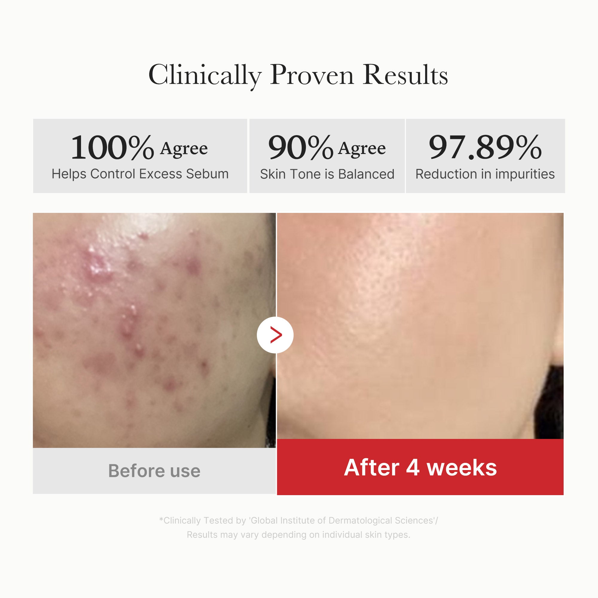Red Succinic Acid Panthenol Pads - Your K-Beauty Pick