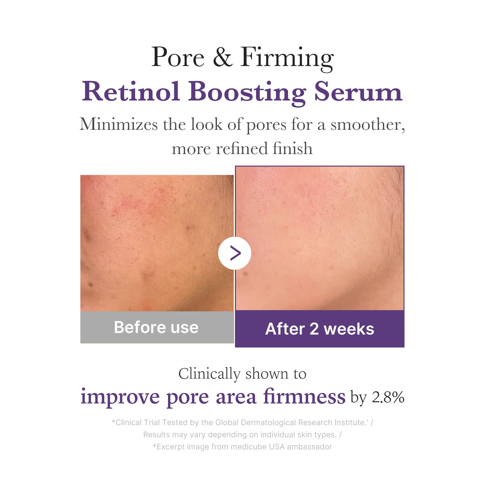 Retinol NMN Boosting Serum - Skin Care Ready