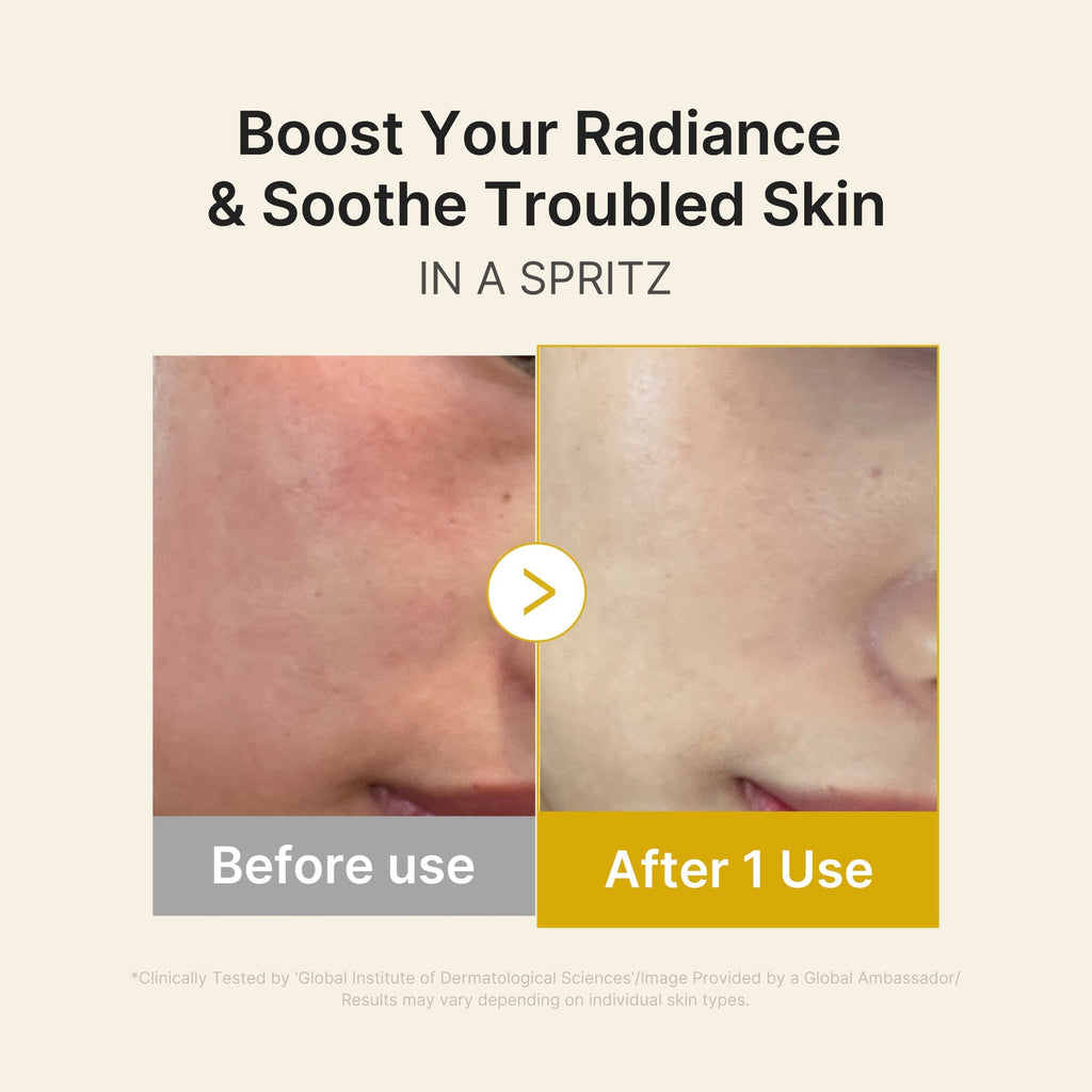 Kojic Acid Turmeric Vitamin Gold Jelly Mist Serum - Better Daily Care