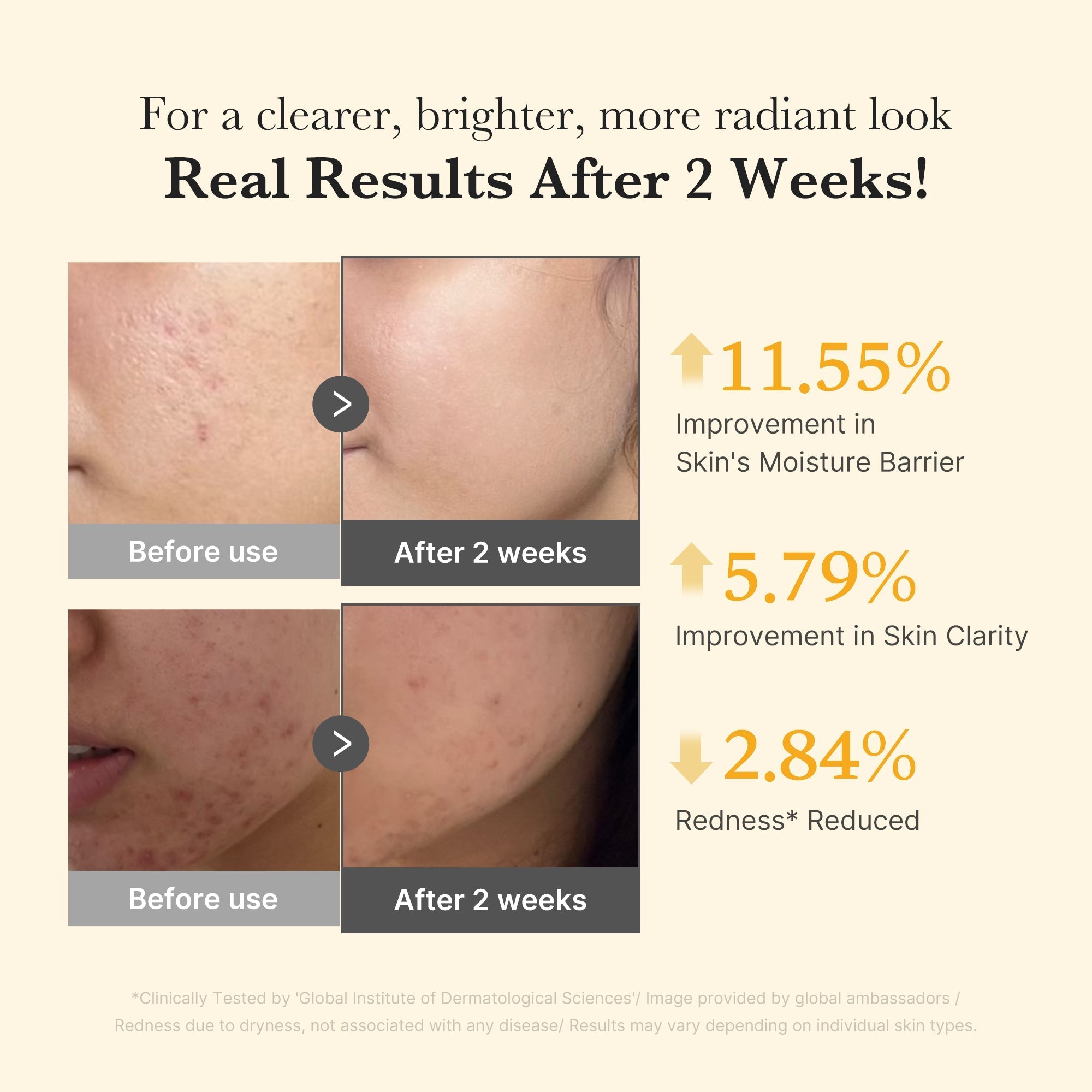 Kojic Acid Turmeric Capsule Serum - Skincare Favorites