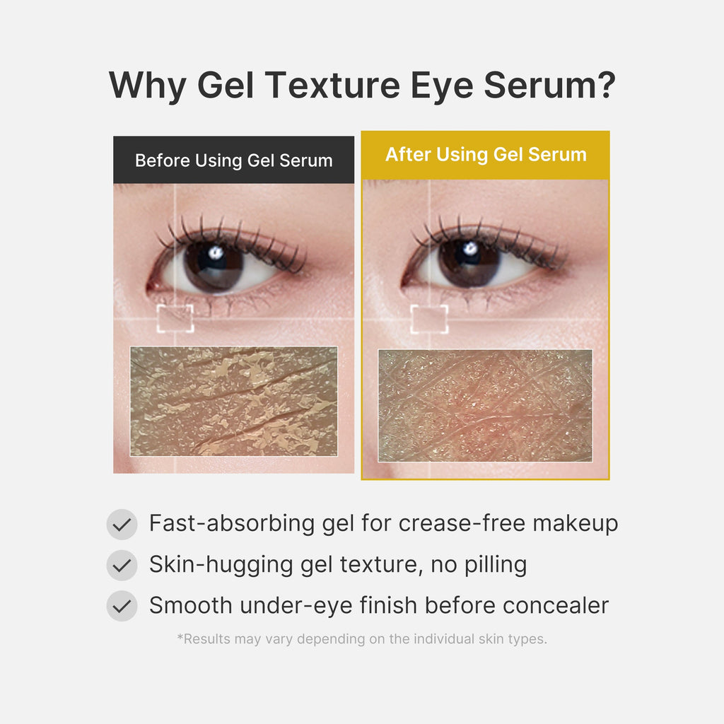 Kojic Acid Tumeric Eye Gel Serum - Beauty Care Daily