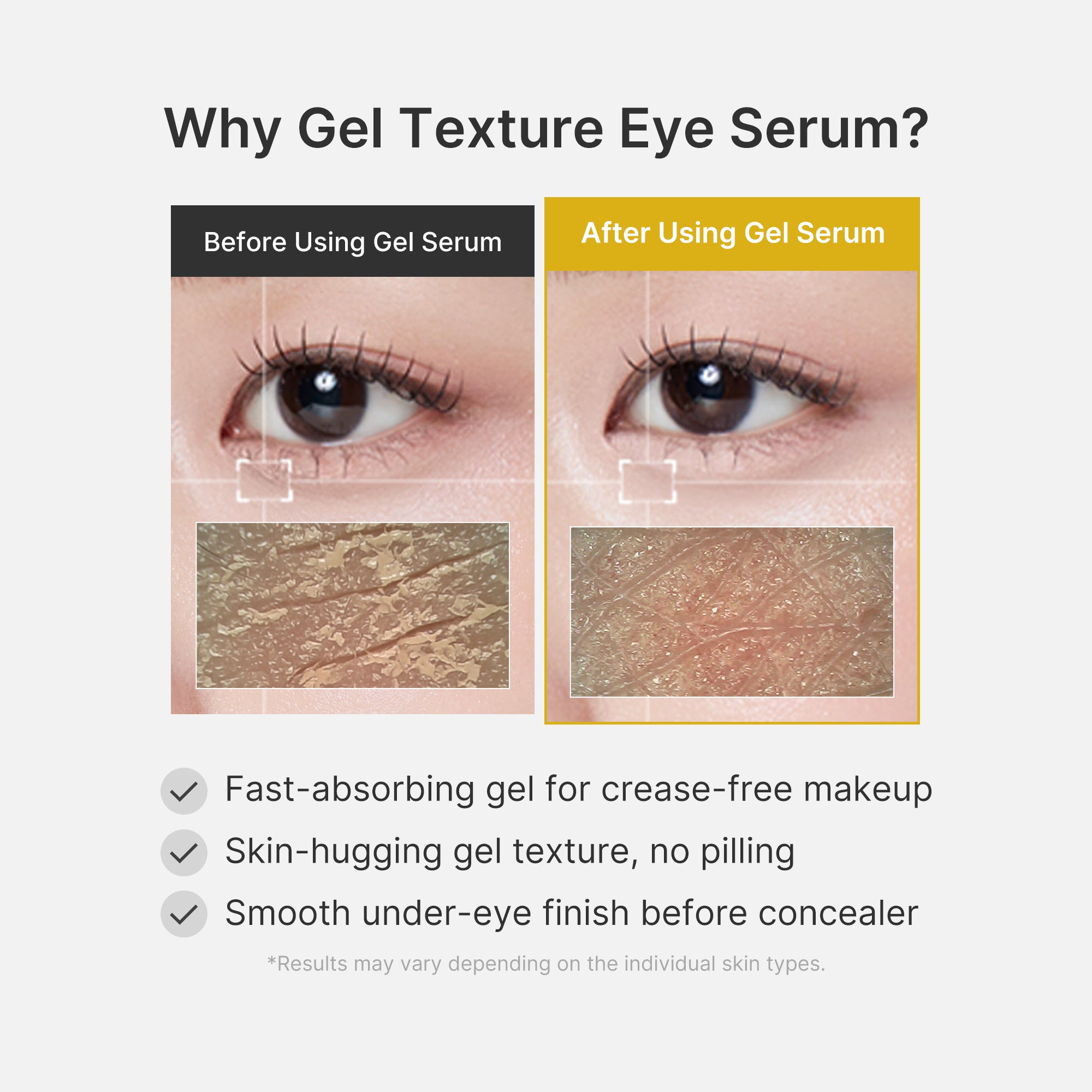 Kojic Acid Tumeric Eye Gel Serum - Beauty Care Daily