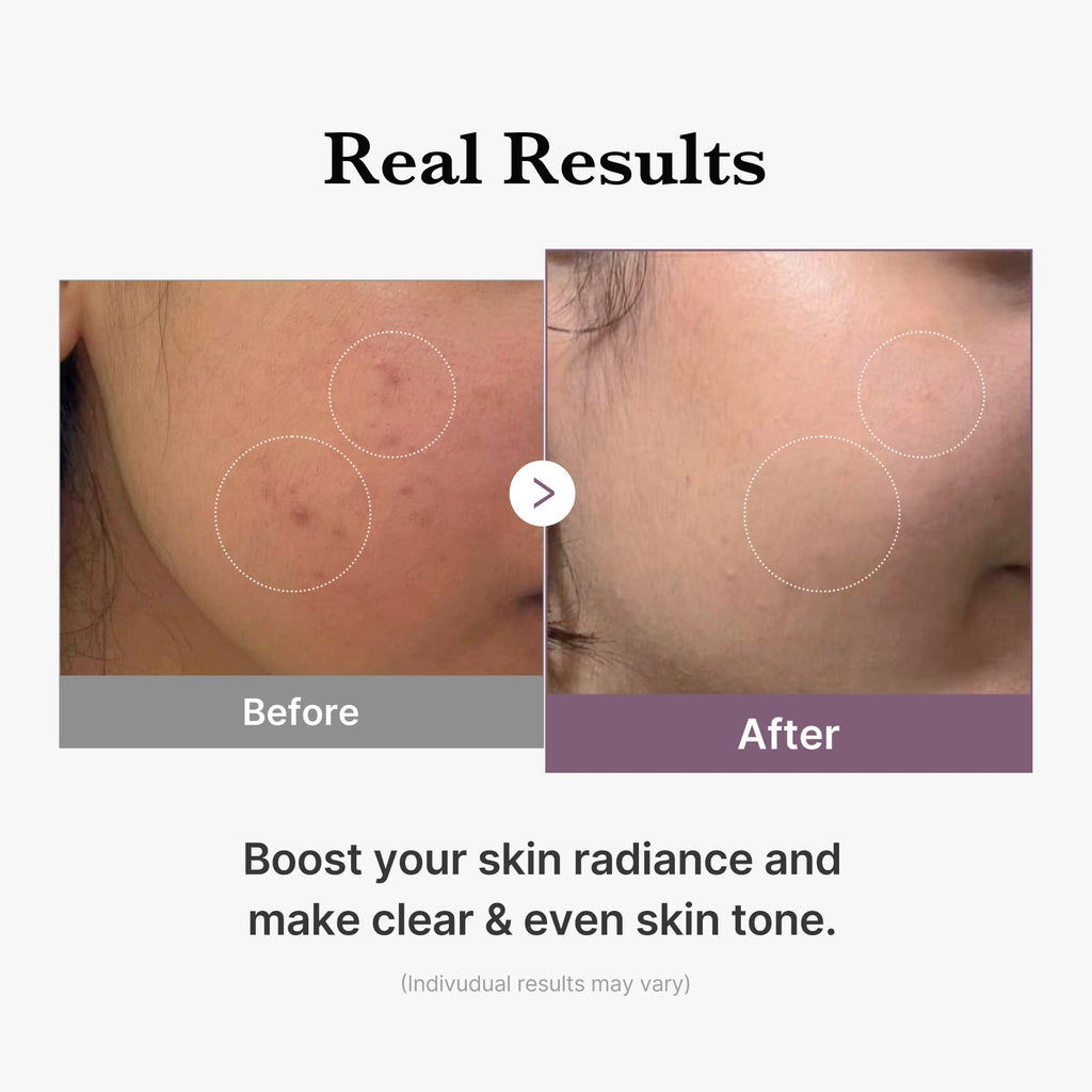 AGE-R Glutathione Glow Milk Toner - Daily Glow Essential