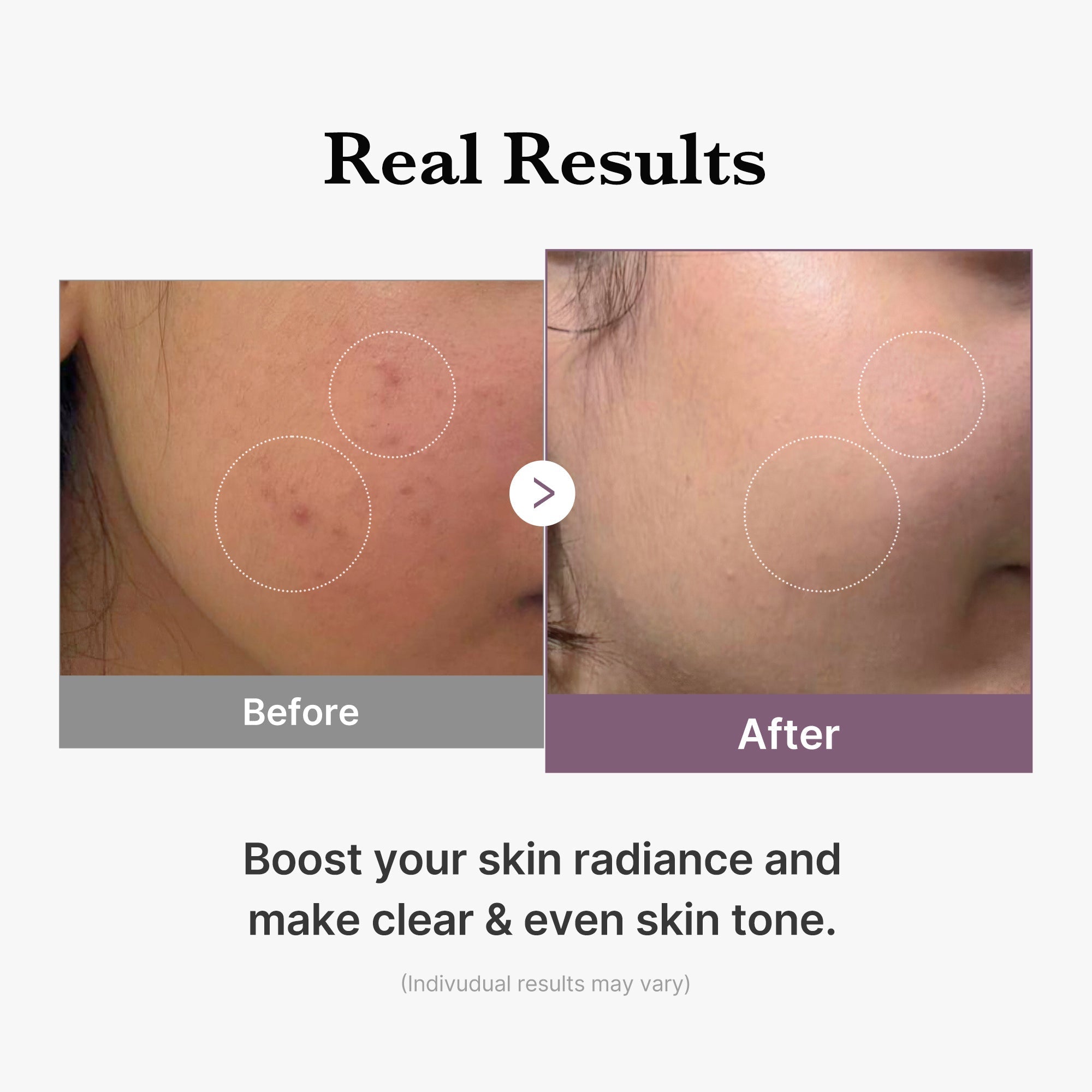 AGE-R Glutathione Glow Milk Toner - Daily Glow Essential