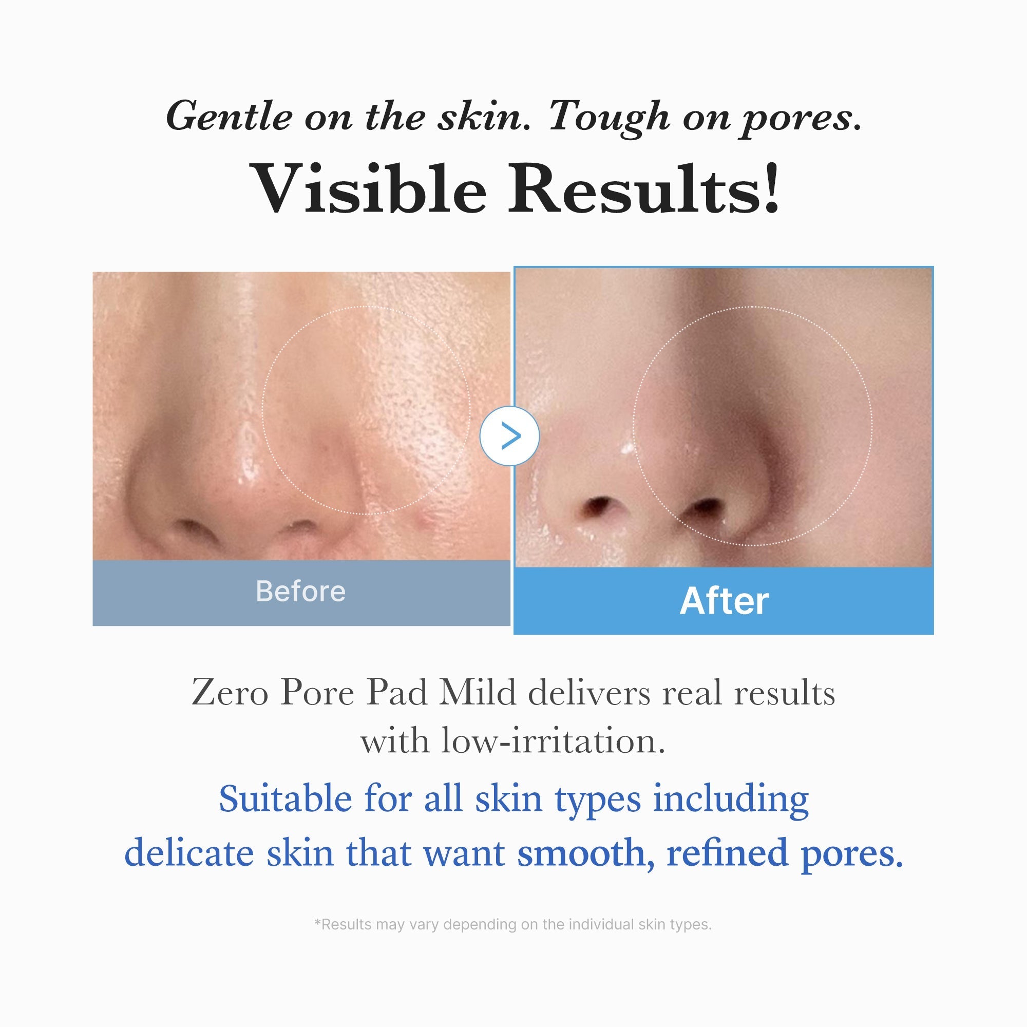 Zero Pore Madecassoside Pads (Mild) - Your Daily Glow