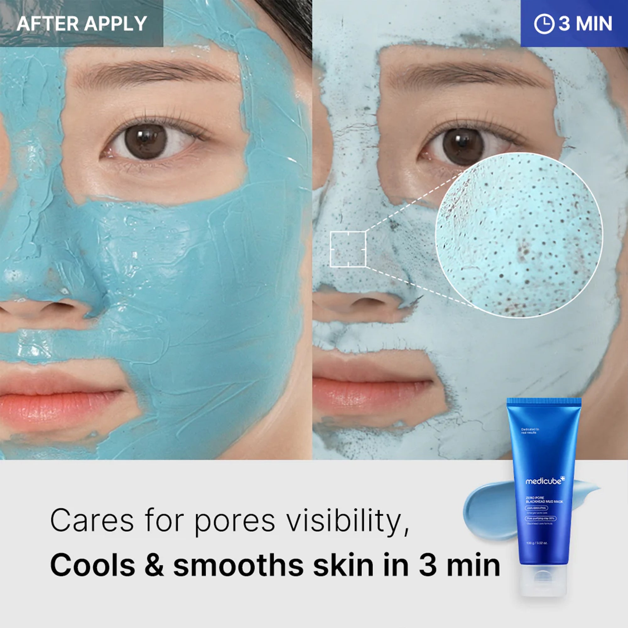 Zero Pore Blackhead Mud Mask - Daily Refresh