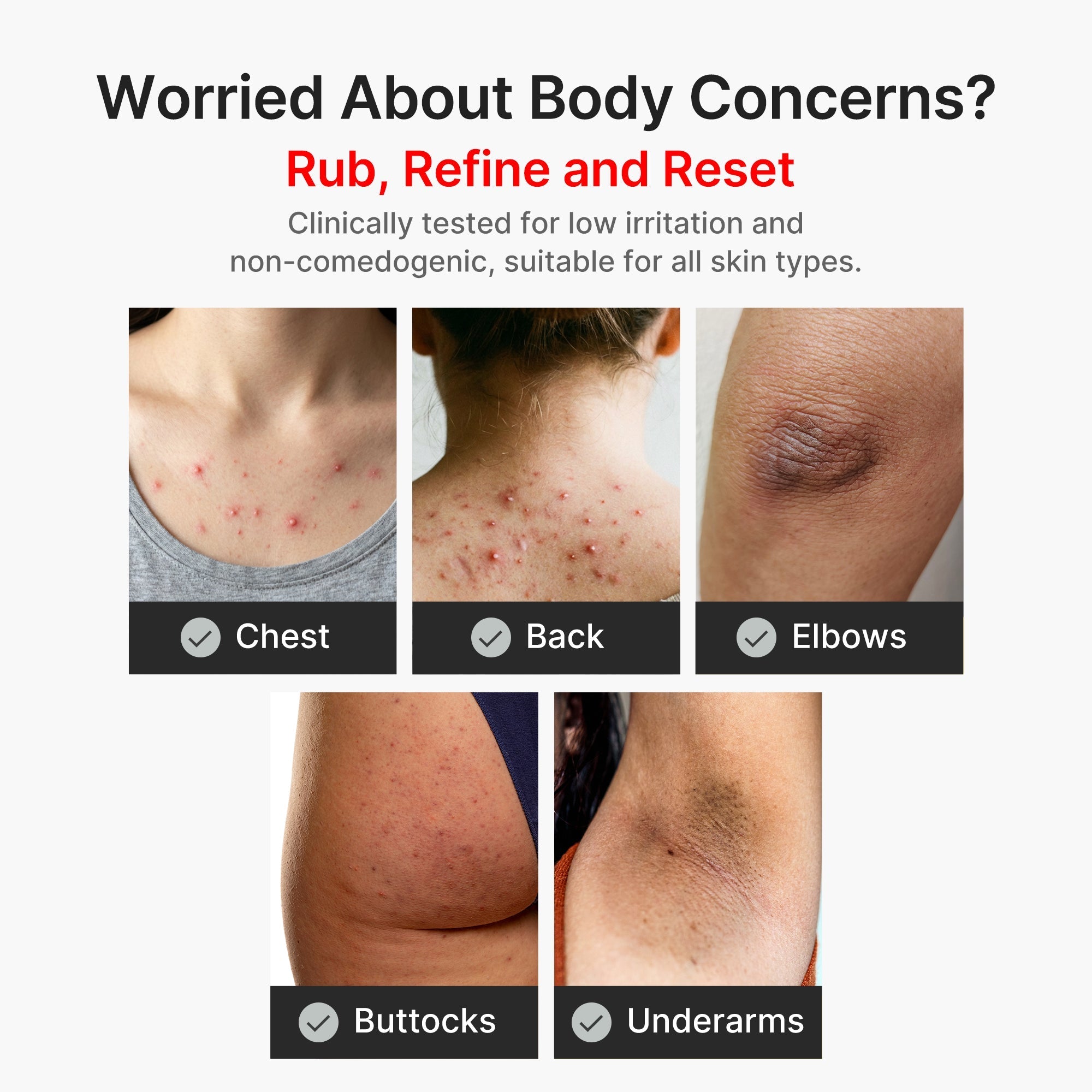 Kojic Acid Turmeric Body Peel Shot - Daily Beauty Care