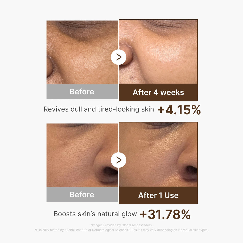 Deep Vitamin C Capsule Serum - Daily Face Care