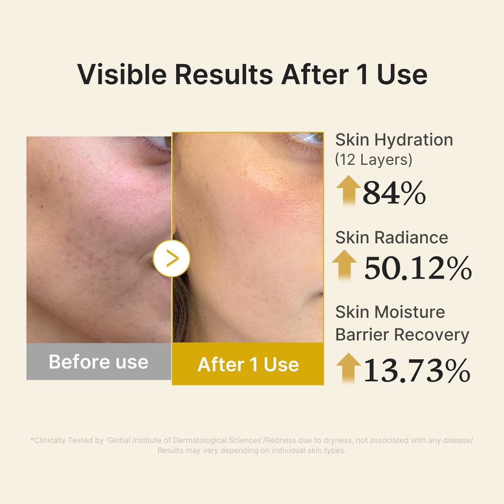 Kojic Acid Turmeric Vitamin Gold Jelly Mist Serum - Better Daily Care