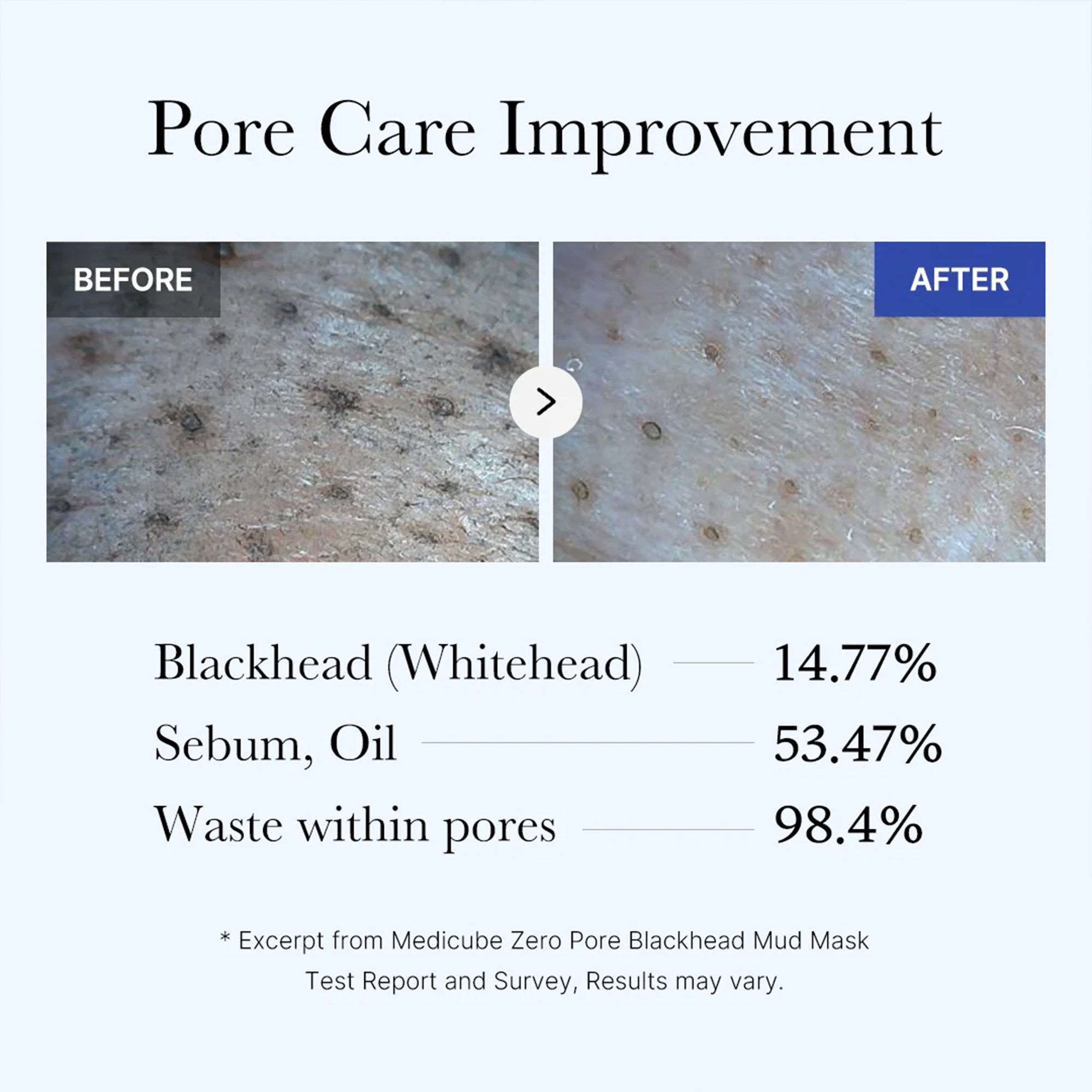 Zero Pore Blackhead Mud Mask - Daily Refresh