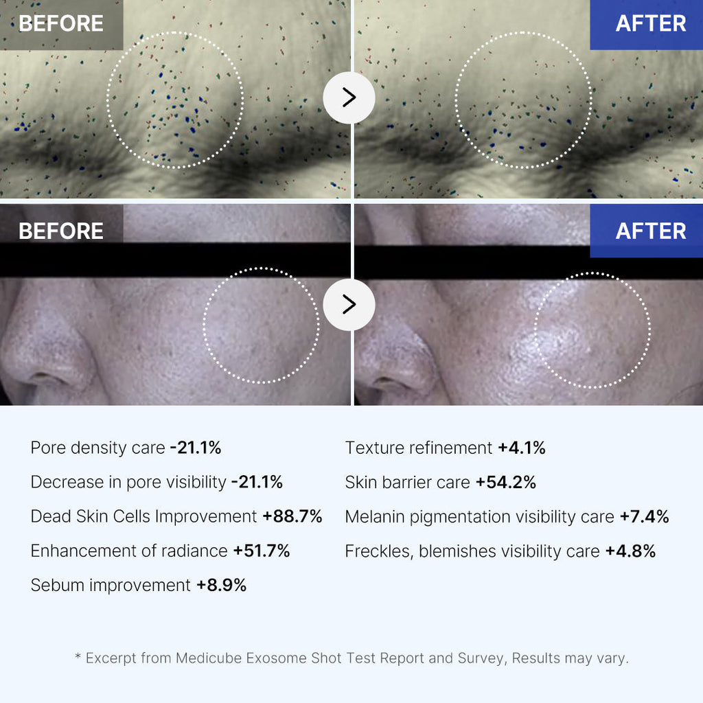 Zero Exosome Shot - Your Skin Routine