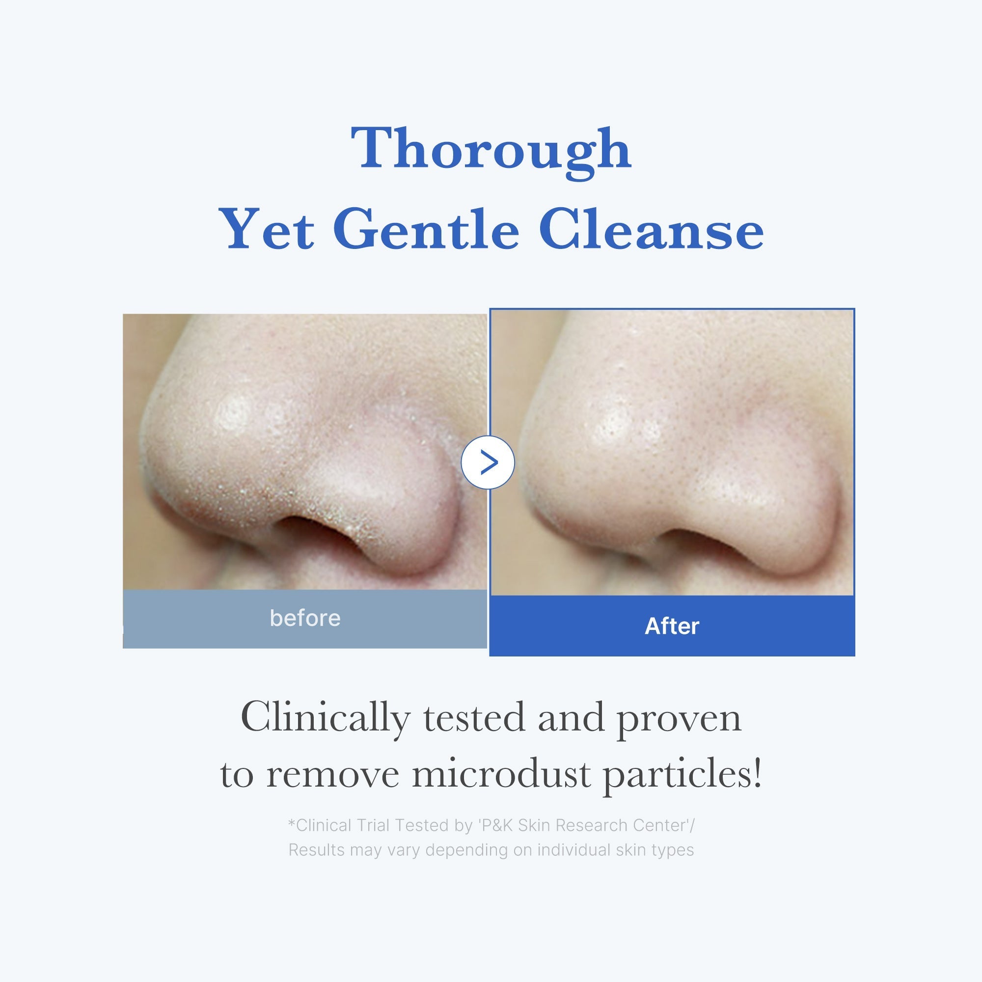 Zero Foam Cleanser - Daily Skin Care