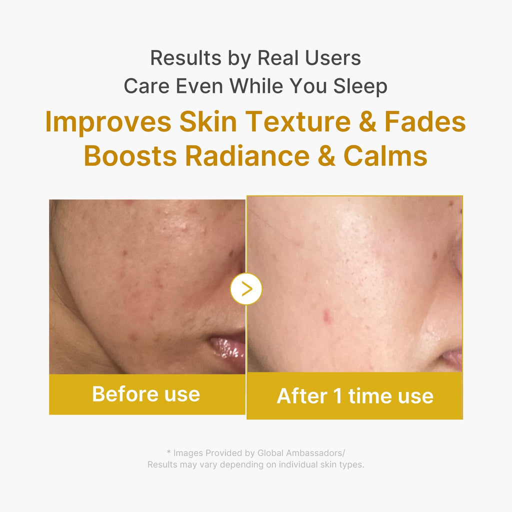 Kojic Acid Turmeric Overnight Wrapping Mask - Glow Skin Pick