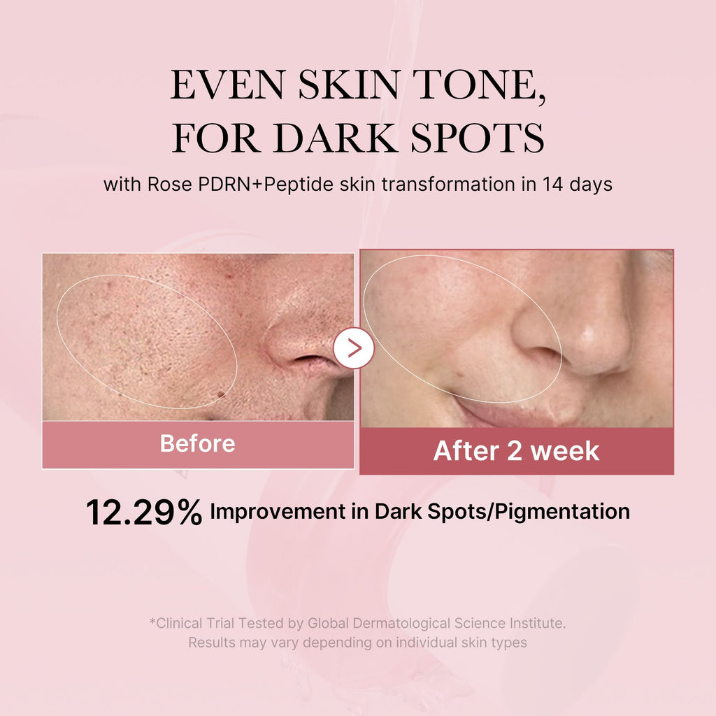 PDRN Pink Peptide Toner - Fresh Care Daily