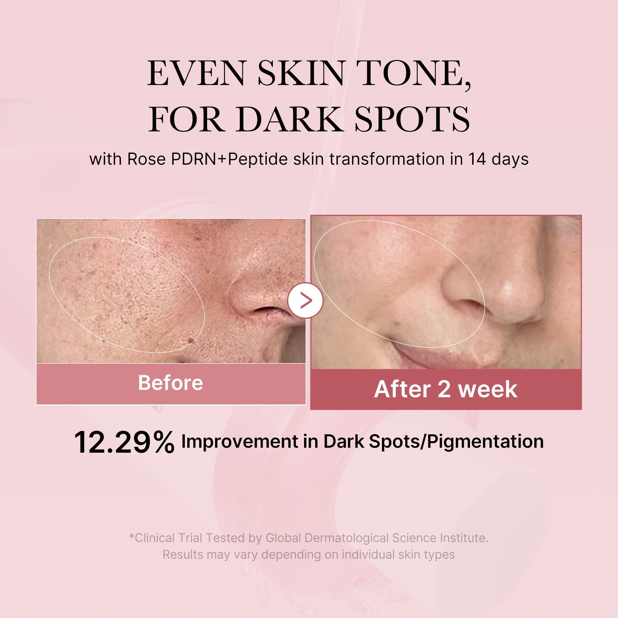 PDRN Pink Peptide Toner - Fresh Care Daily