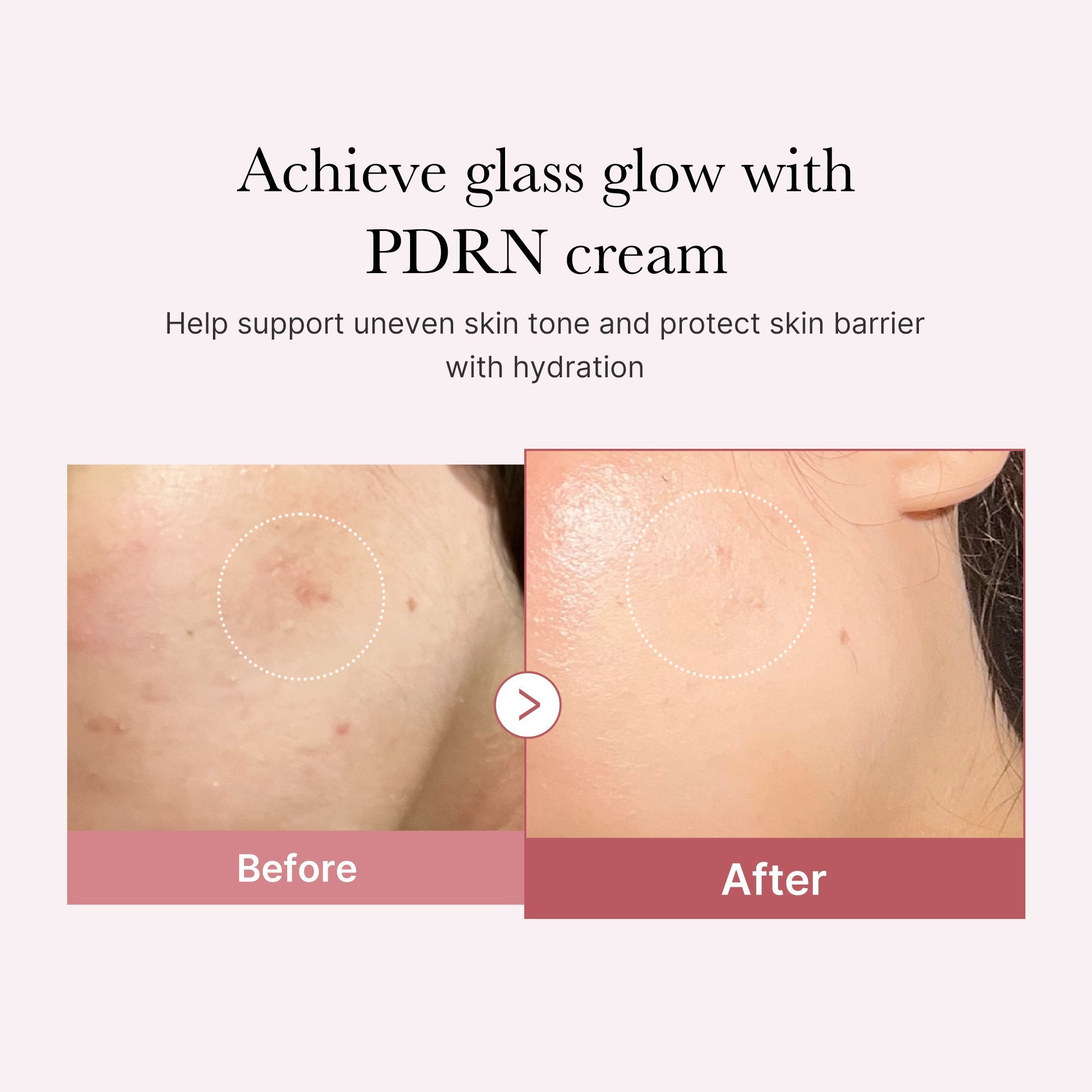 PDRN Pink Peptide Cream - K-Beauty Essentials
