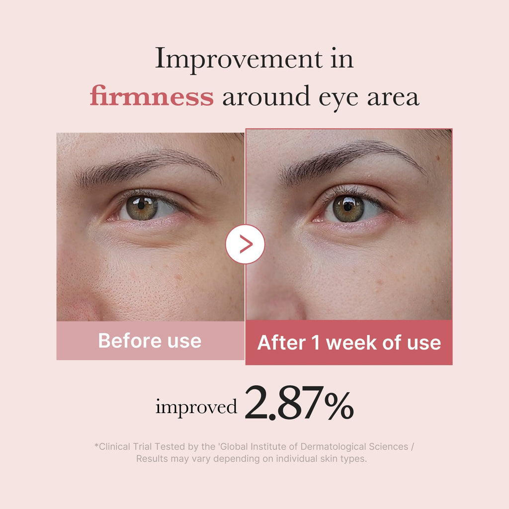 PDRN Pink Peptide Eye Cream - Easy Daily Care