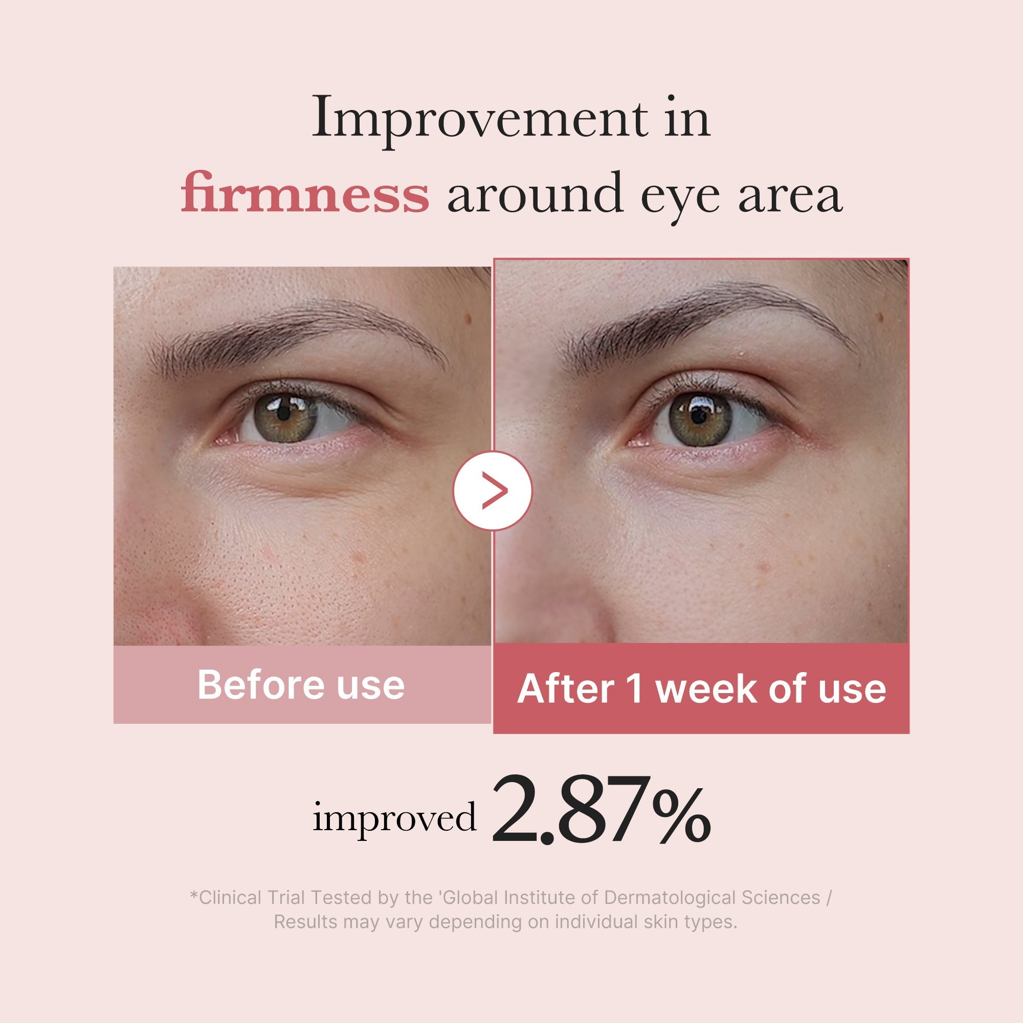 PDRN Pink Peptide Eye Cream - Easy Daily Care