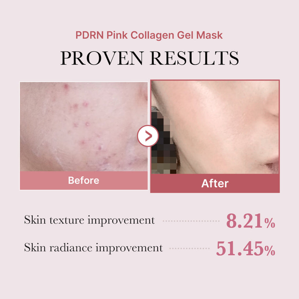 PDRN Pink Glow Full Set - Fresh Skin Routine