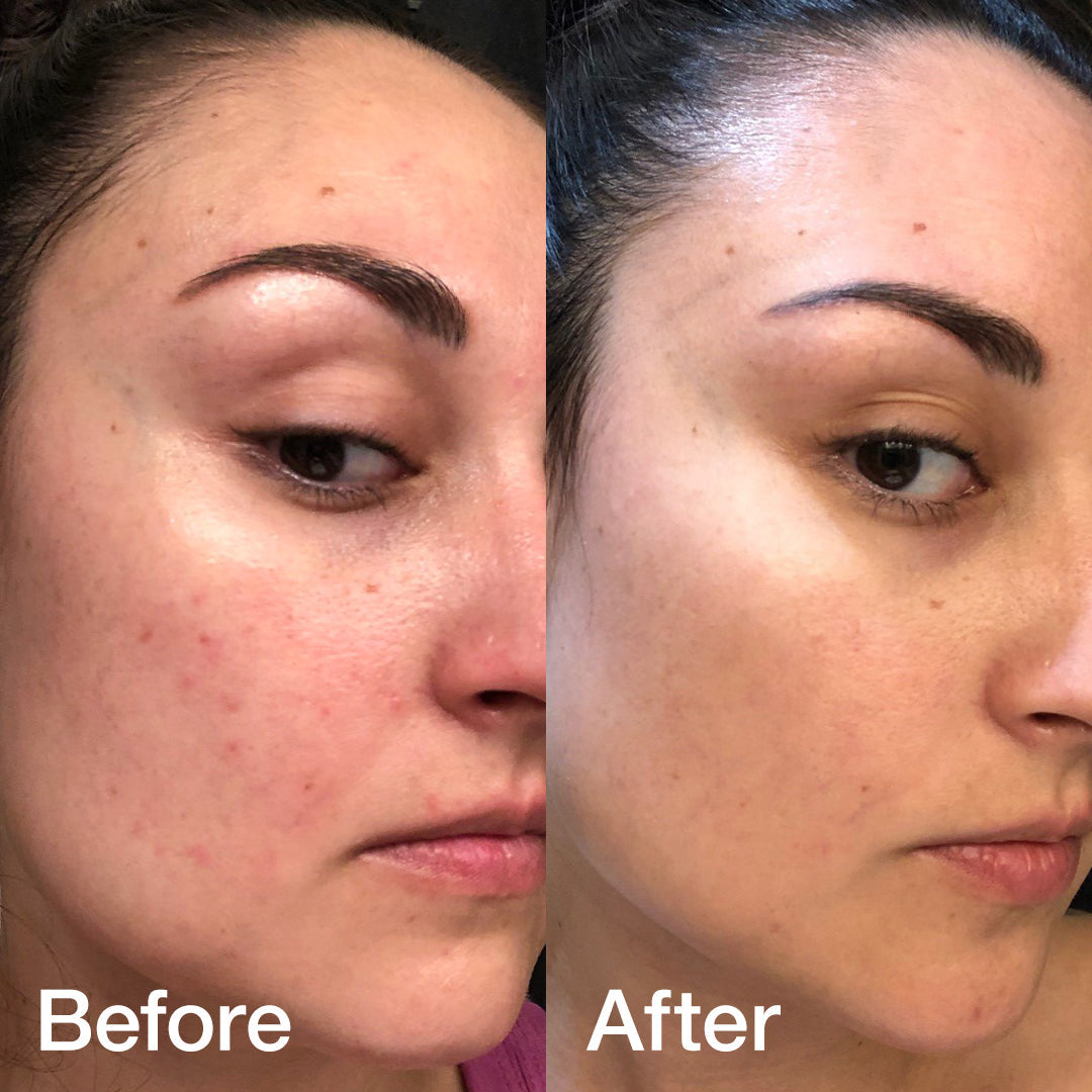 Glass Glow Duo - Routine Made Easy