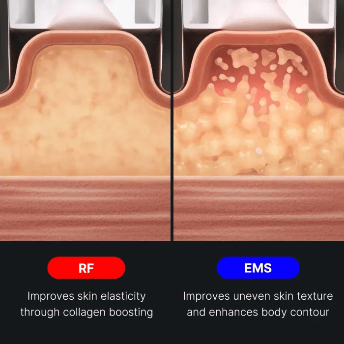 AGE-R Contour Body Shot - Your Daily Care Pick