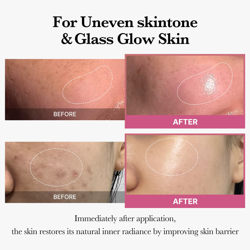 [Tati's Exclusive] All About Glow Set - Daily Glow Care